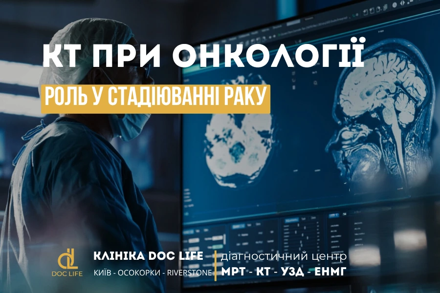 КТ при онкології: роль у стадіюванні раку 1 Кт При Онкології 1
