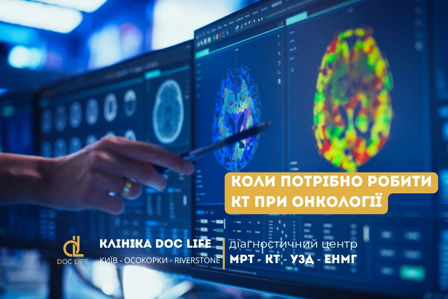 Кт При Онкології: Роль У Стадіюванні Раку