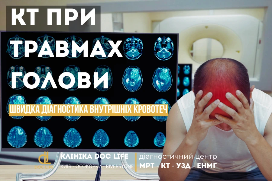 Кт При Травмах Голови 1