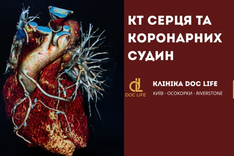 Кт Серця Та Коронарних Судин 5