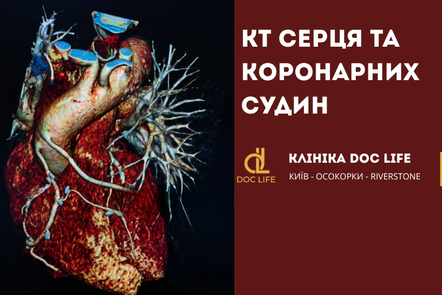 КТ серця та коронарних судин: діагностика ішемії 1 Кт Серця Та Коронарних Судин 5