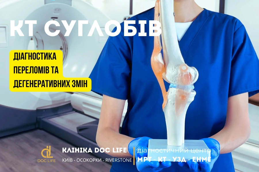 КТ суглобів: діагностика переломів та дегенеративних змін 1 Кт Суглобів Діагностика Переломів Та Дегенеративних Змін 1