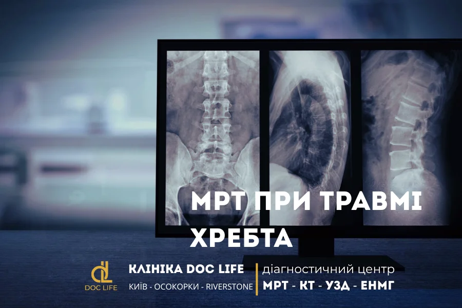 Мрт При Травмі Хребта У Києві