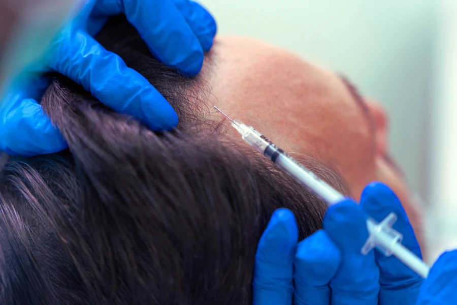 Хто такий трихолог і коли звертатись до нього 14 Hto Takyj Tryholog I Koly Zvertatys Do Nogo 4