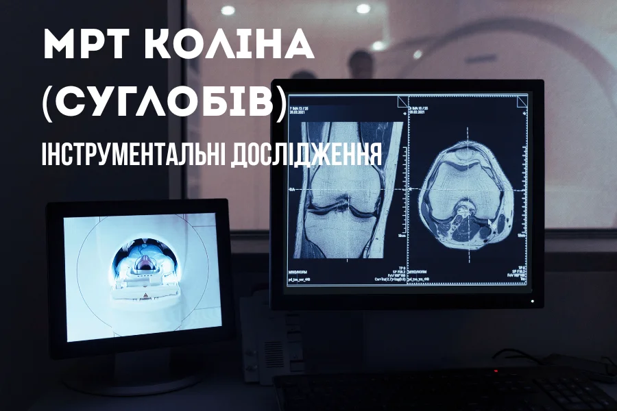 МРТ суглобів — для детального аналізу хряща, зв’язок і м’яких тканин (МРТ Коліна) ; Мрт Суглобів — Для Детального Аналізу Хряща, Зв’язок І М’яких Тканин (Мрт Коліна) ;