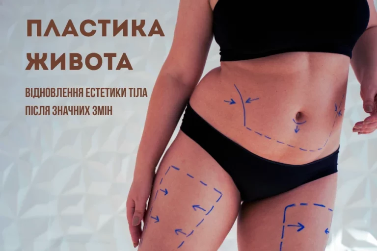 Пластика живота: відновлення естетики тіла після значних змін 2 Plastyka 1