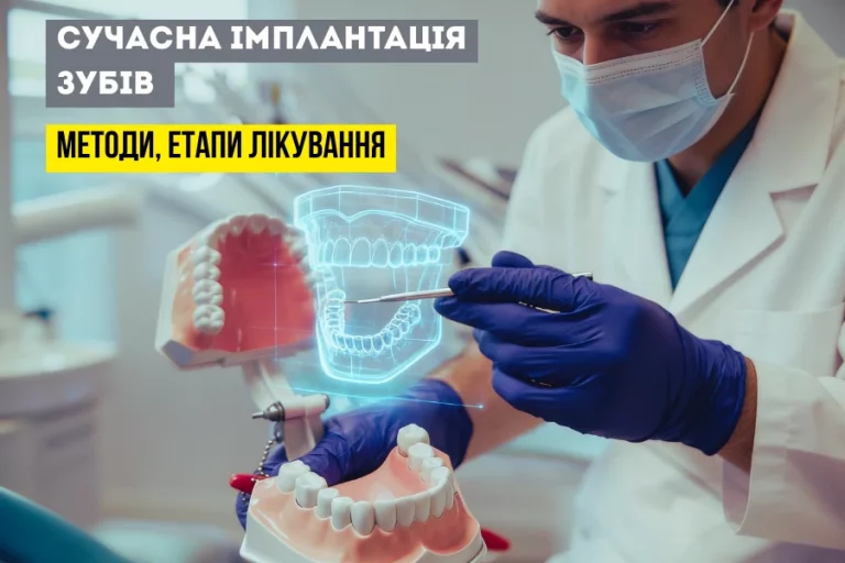 Сучасні Методи Лікування Імплантів 3