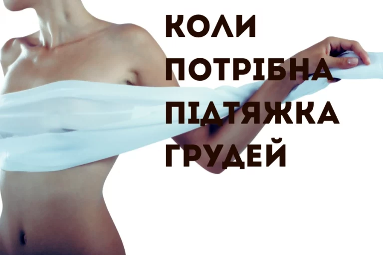 Коли потрібна підтяжка грудей: 5 ознак, що час звернутися до хірурга 2 Koly Potribna Pidtyazhka Grudej 1