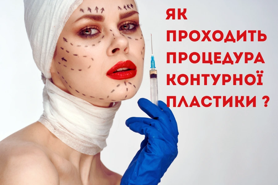 Як проходить контурна пластика - етапи процедури та відновлення 11 Процедура Контурної Пластики 1