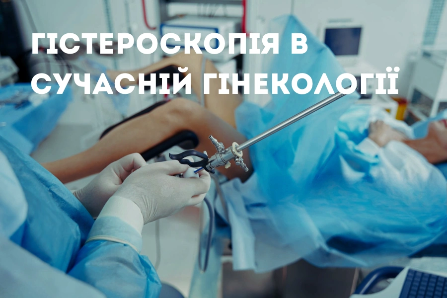 Гістероскопія в сучасній гінекології: можливості та переваги обладнання 12 Що Таке Гістероскопія В Сучасній Гінекології 3