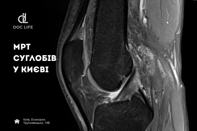 МРТ суглобів у Києві (Осокорки) — ціна від 2800 грн | DocLife 3 Мрт Суглобів У Медичному Центрі Doclife