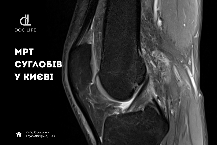 МРТ суглобів у Києві (Осокорки) — ціна від 2800 грн | DocLife 10 Мрт Суглобів У Медичному Центрі Doclife