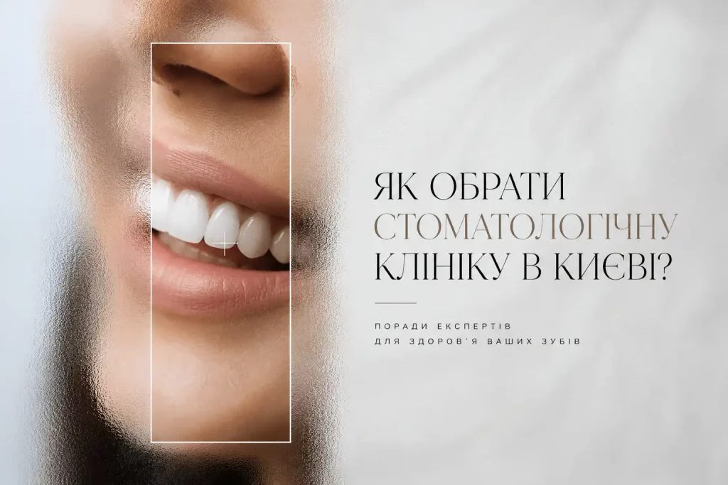 Як обрати стоматологічну клініку в Києві: поради експертів 10 Obraty Stomatologichnu Kliniku V Kyyevi 3