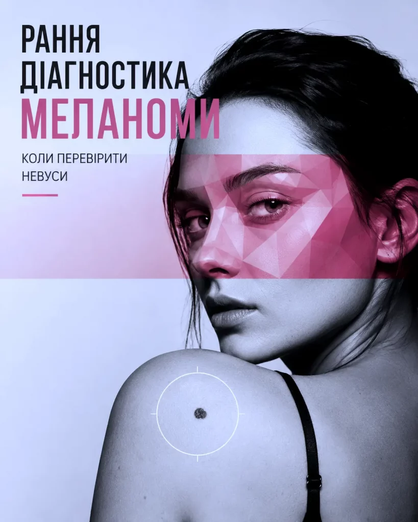 рання діагностика меланоми 02 Рання Діагностика Меланоми 02