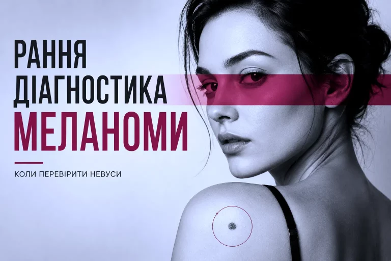 Рання діагностика меланоми 4 Рання Діагностика Меланоми 03